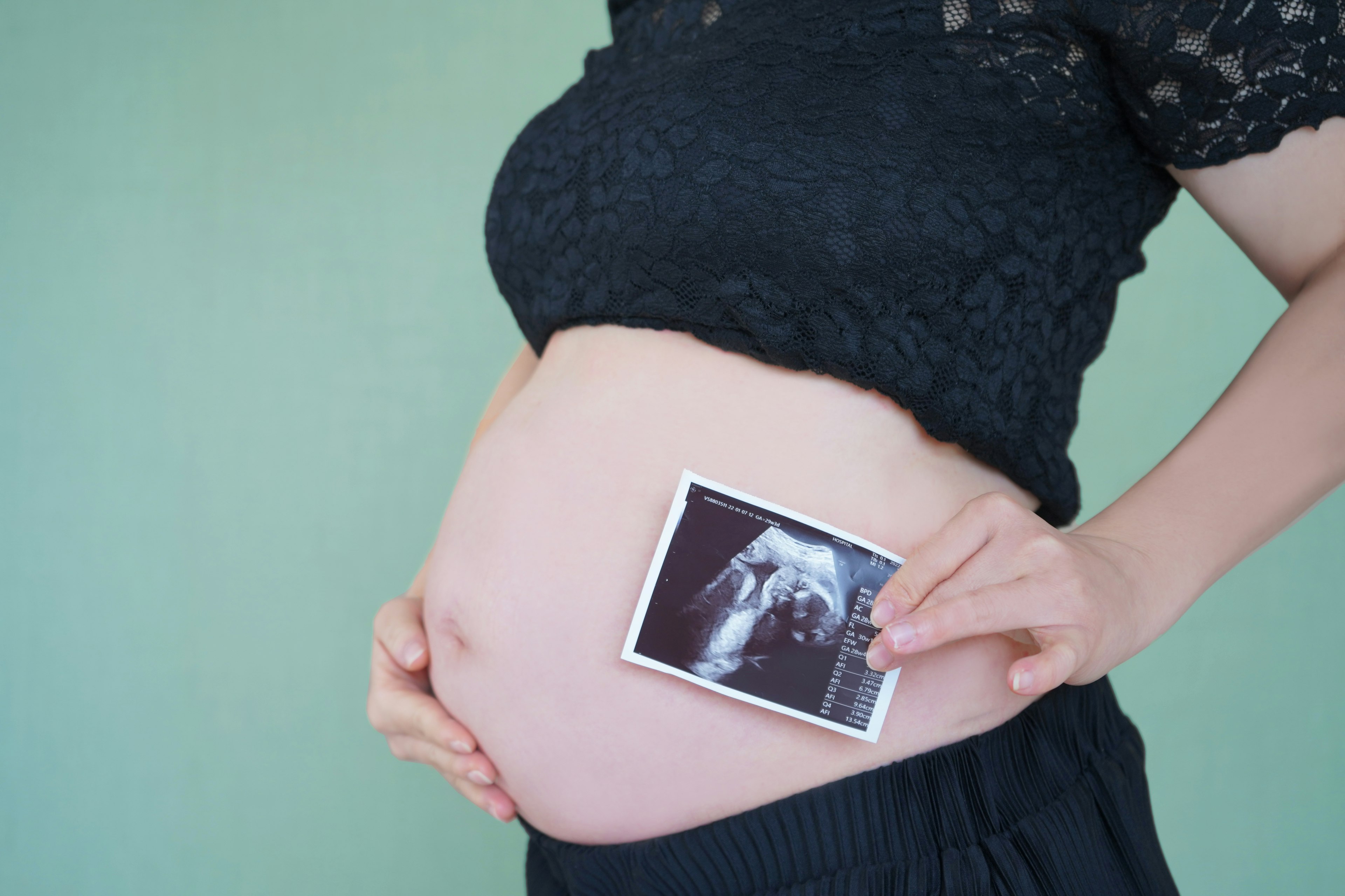 Schwangere Frau hält Ultraschallbild auf ihrem Bauch