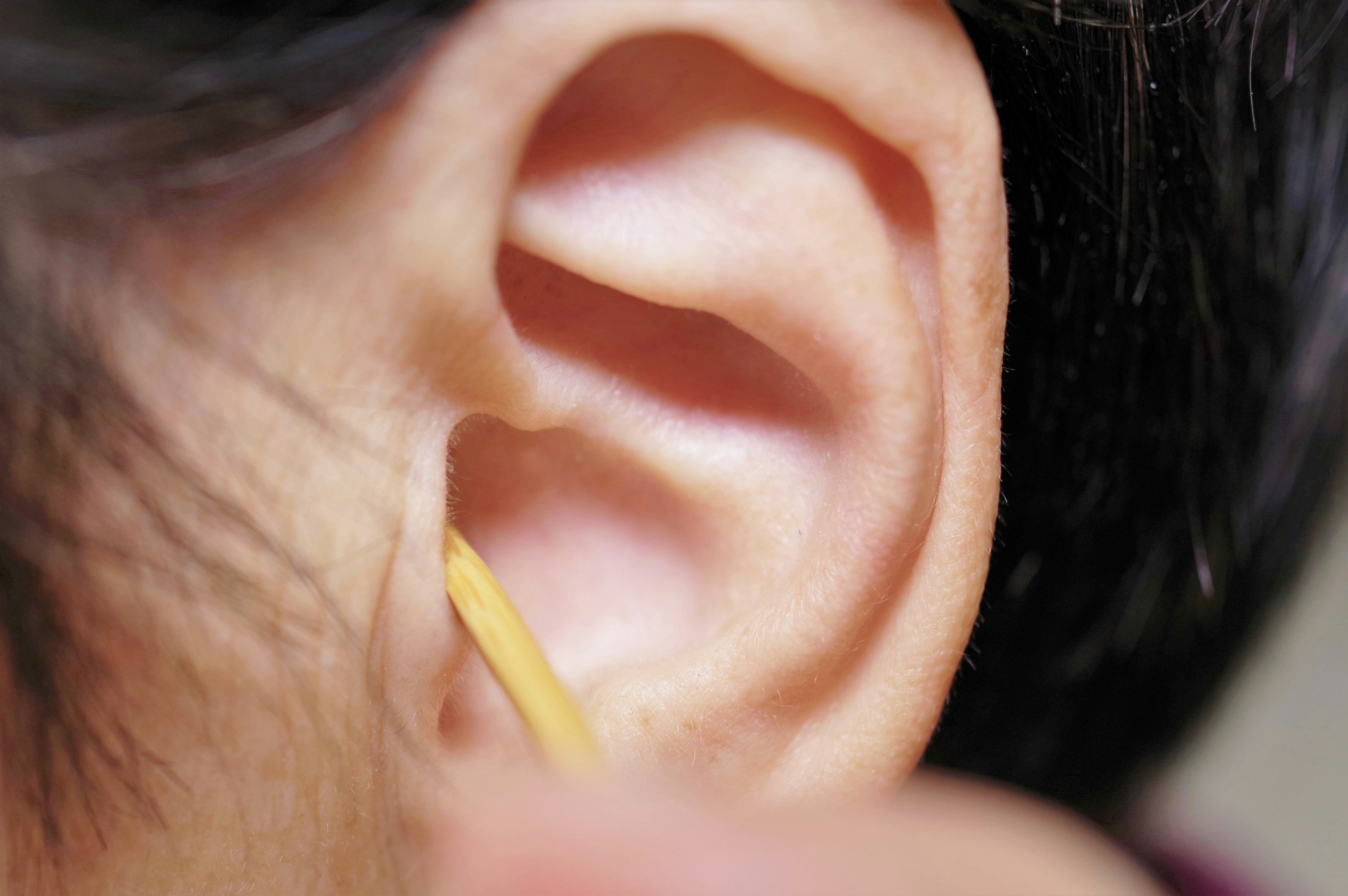 Gros plan sur une oreille avec un cure-oreille jaune inséré