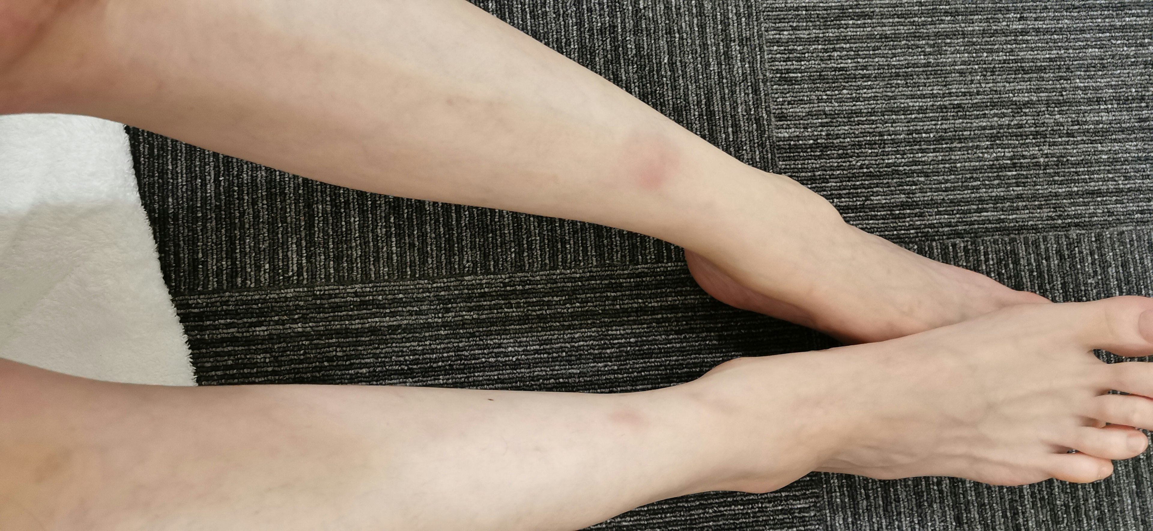 A person's legs showing ankles and calves