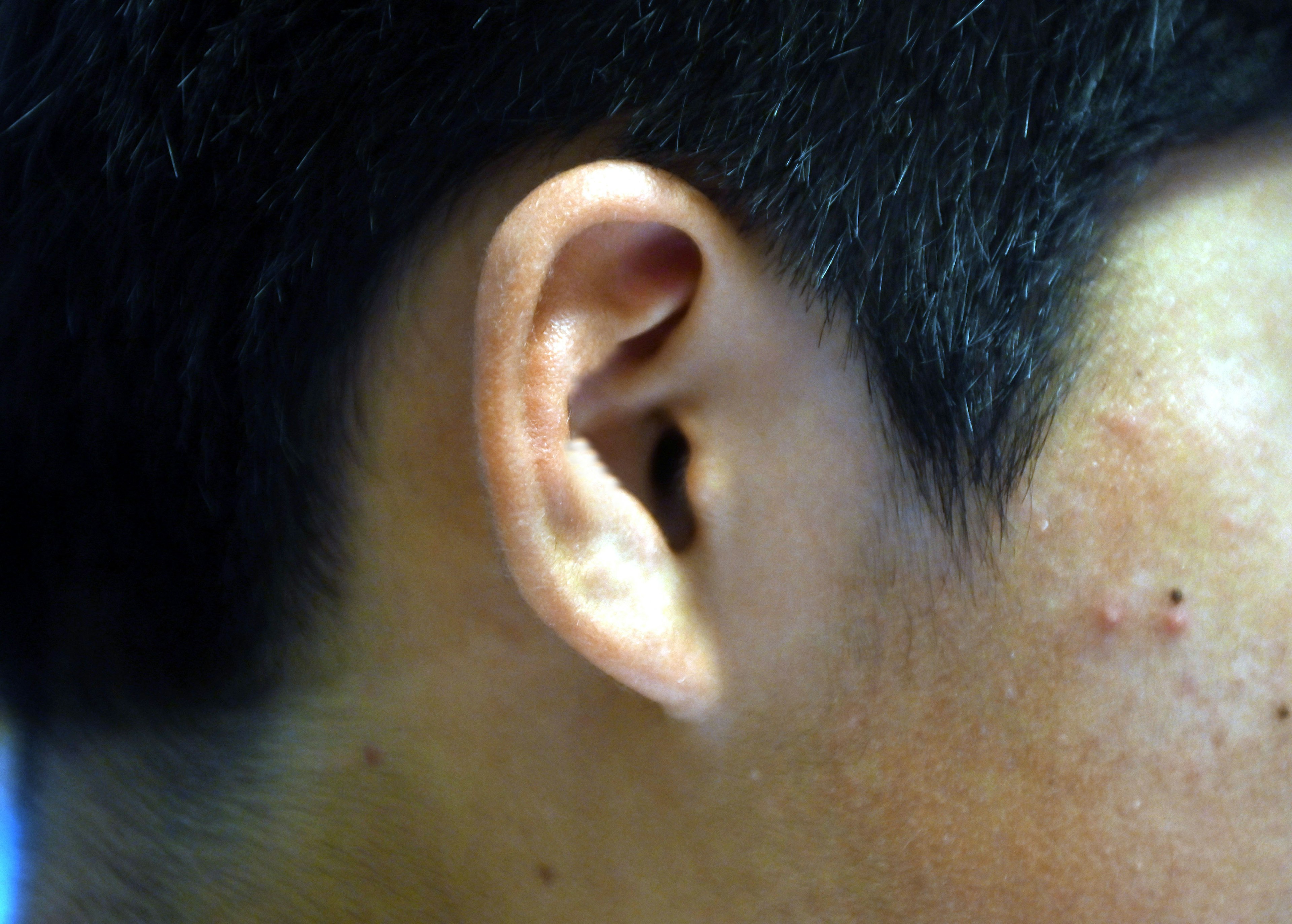 Close-up of a human ear and skin details