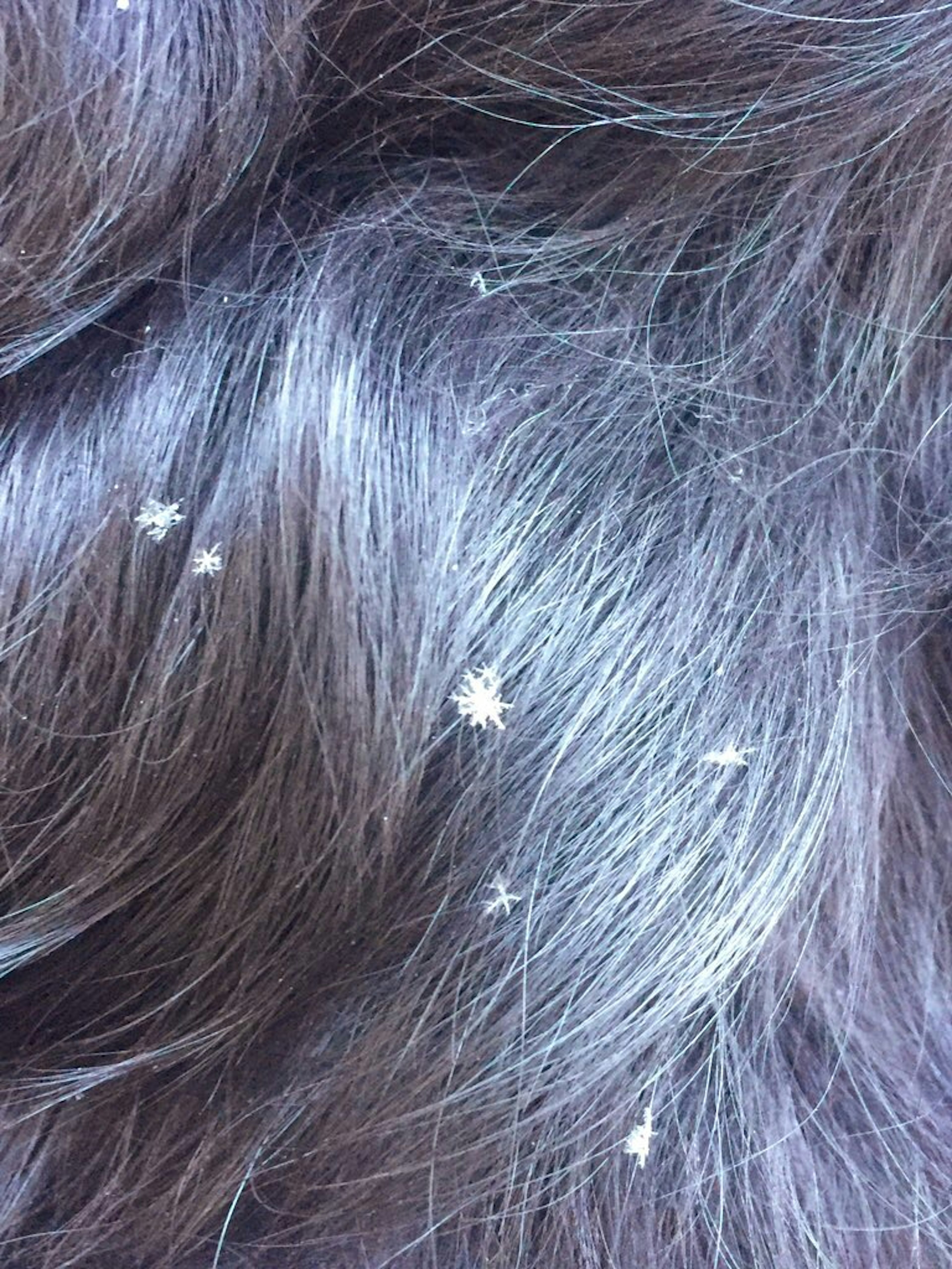 Cabello oscuro con copos de nieve blancos esparcidos