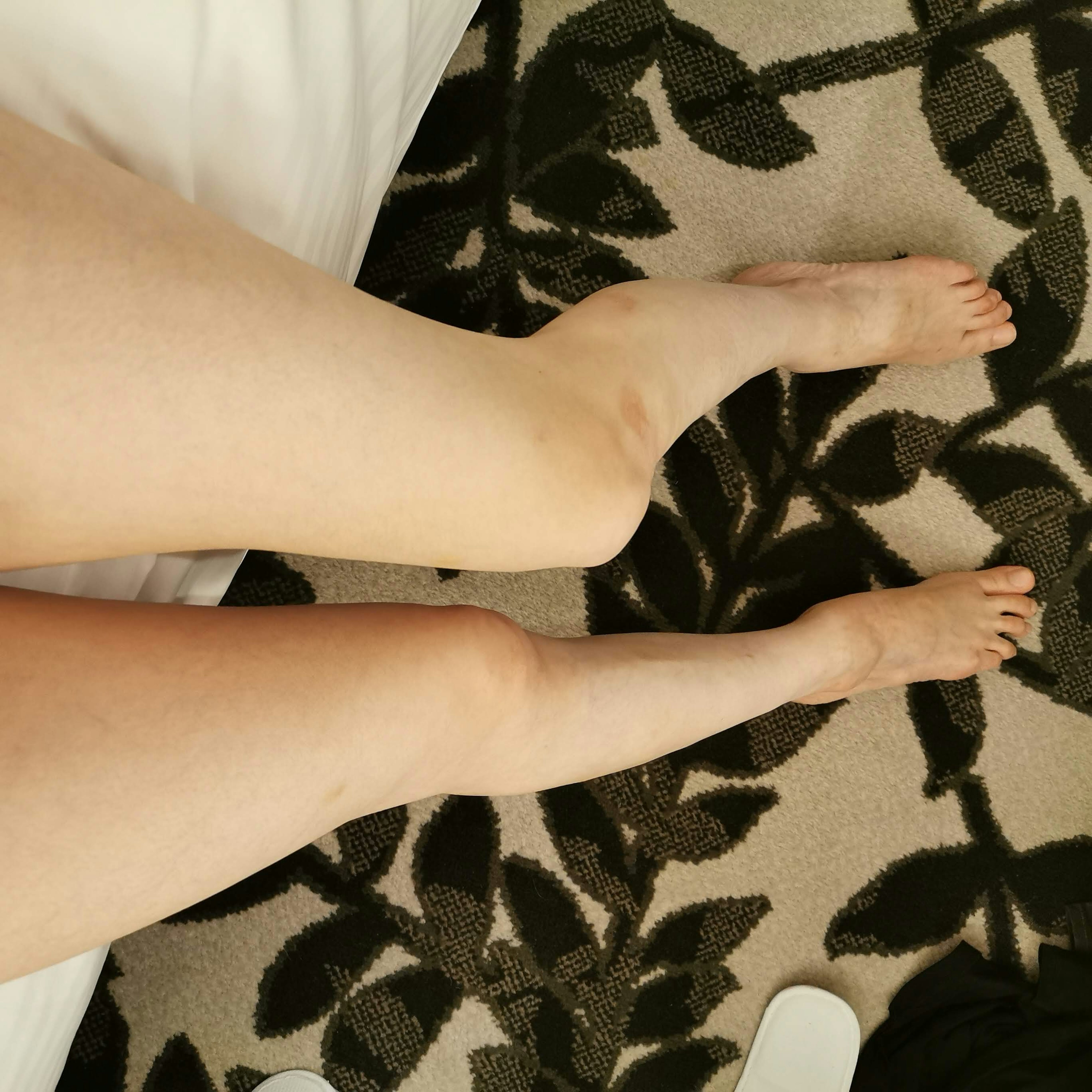 Bare legs resting on a leaf-patterned carpet with a soft bed