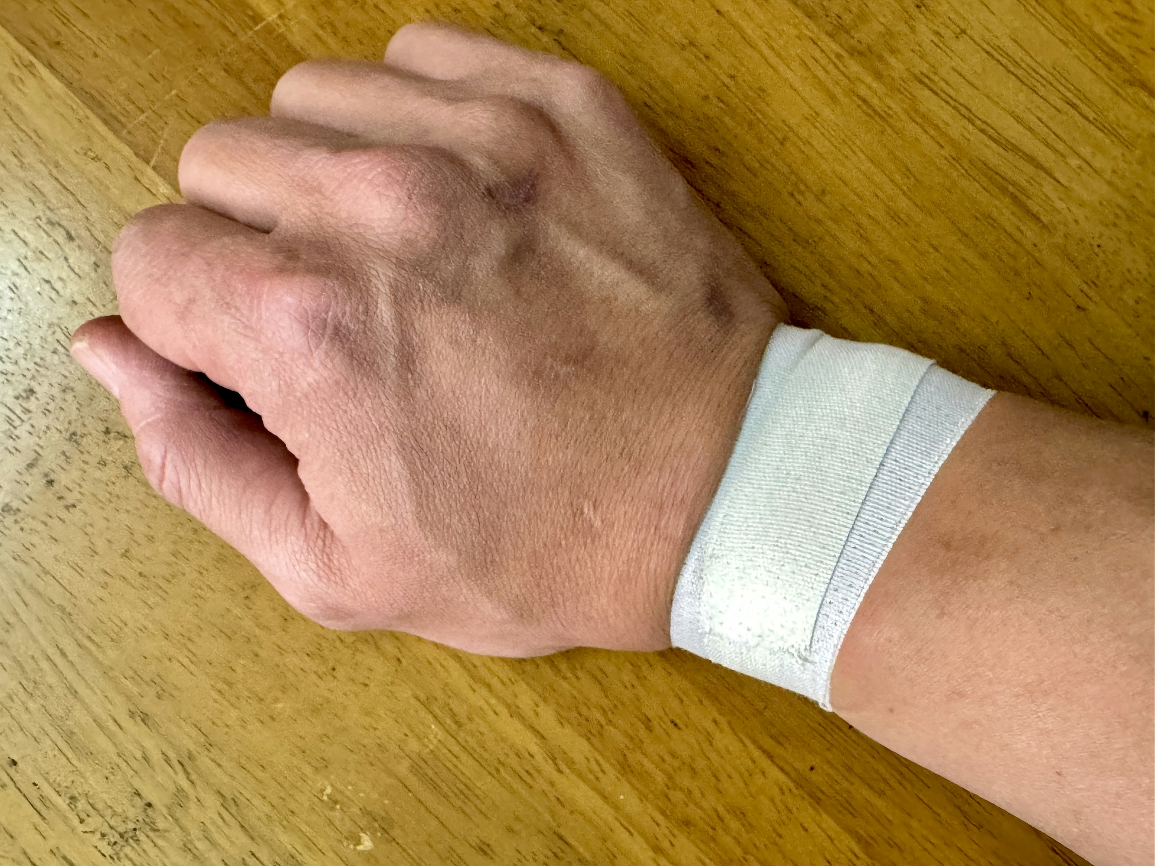 A hand with a white bandage on the wrist