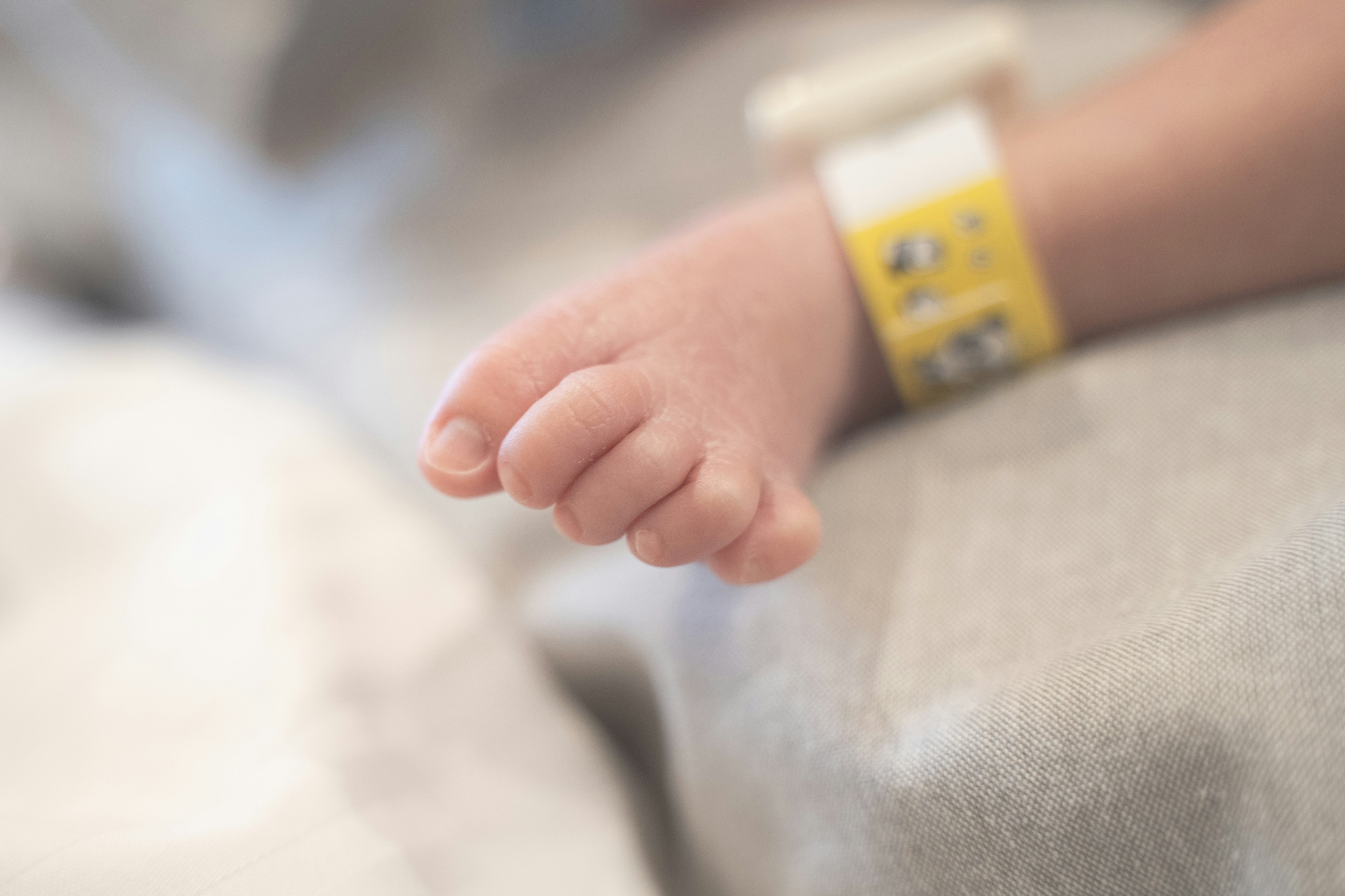 A close-up of a baby's tiny foot with a yellow hospital wristband