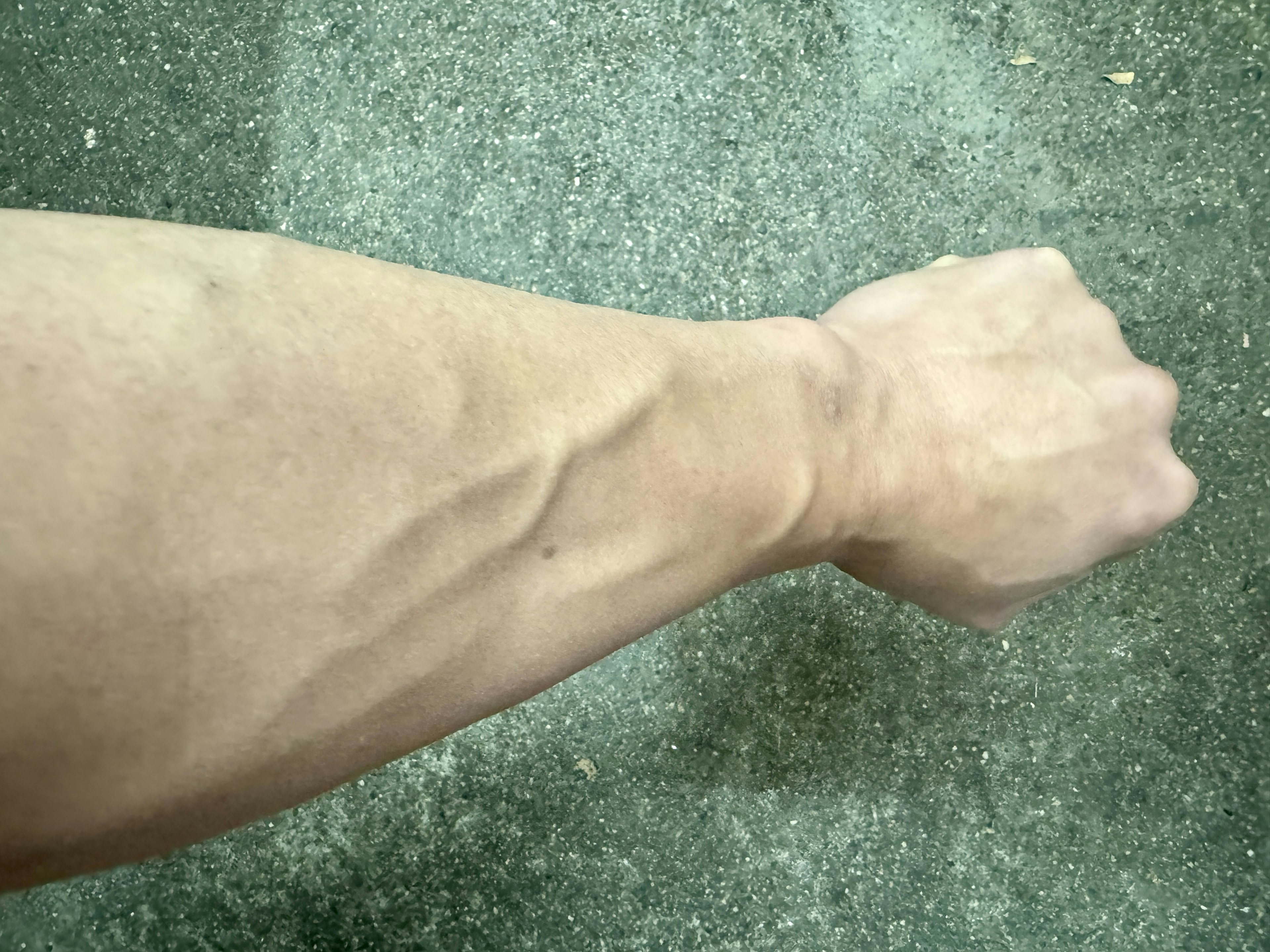 Photo of a forearm with visible muscles and veins