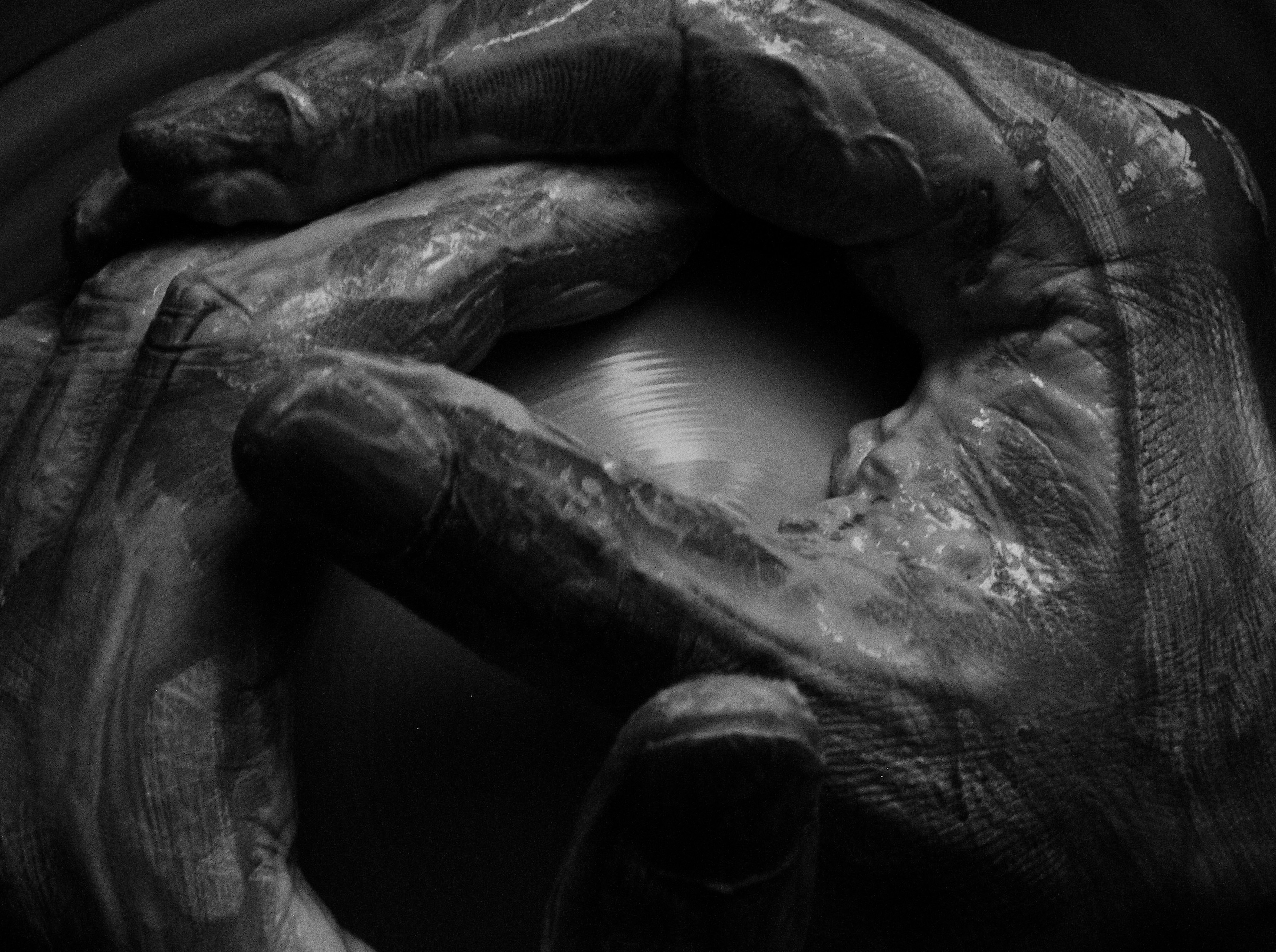 Black and white image of hands gently cradling a round object