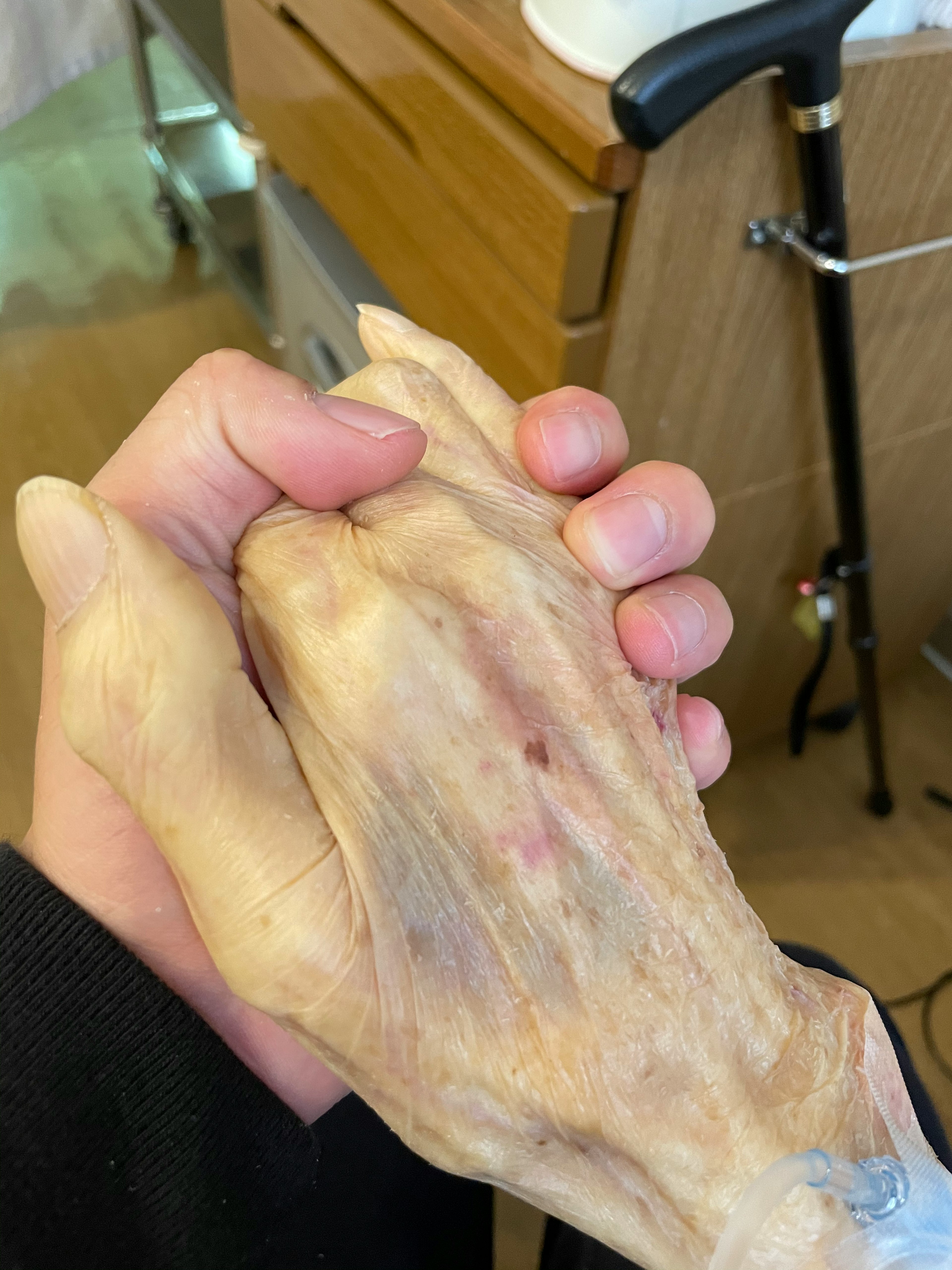 A human hand holding a prosthetic hand