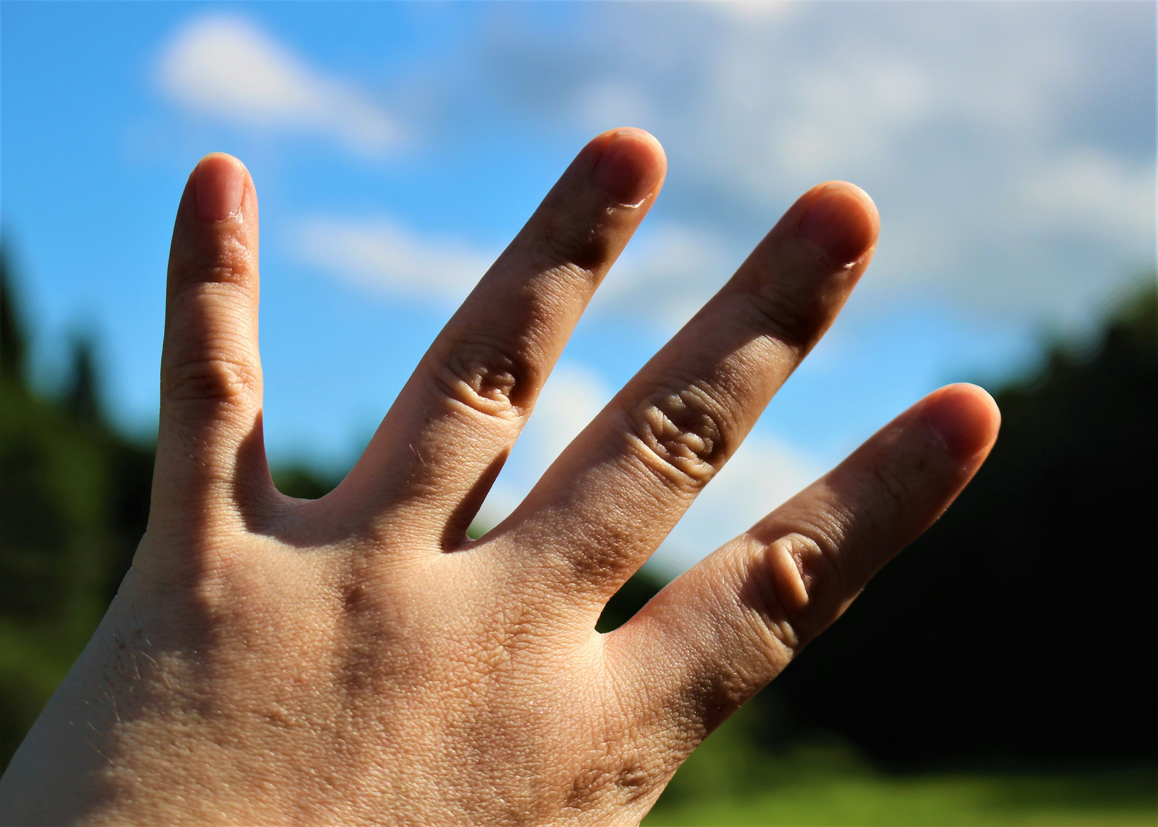 An open hand against a blue sky background