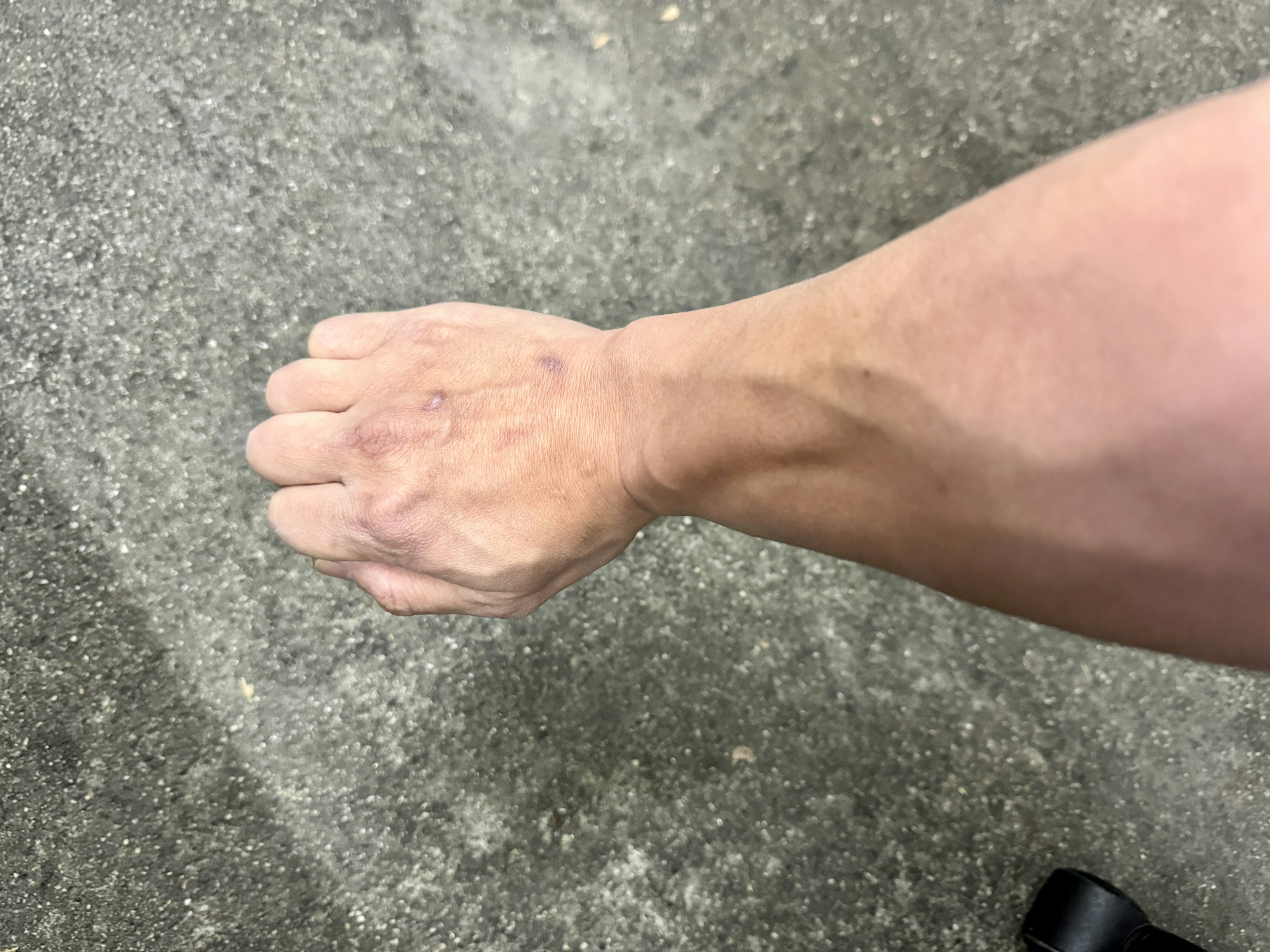 Foto eines Arms vom Handgelenk bis zum Ellenbogen mit nach oben gerichteter Handfläche und gekrümmten Fingern