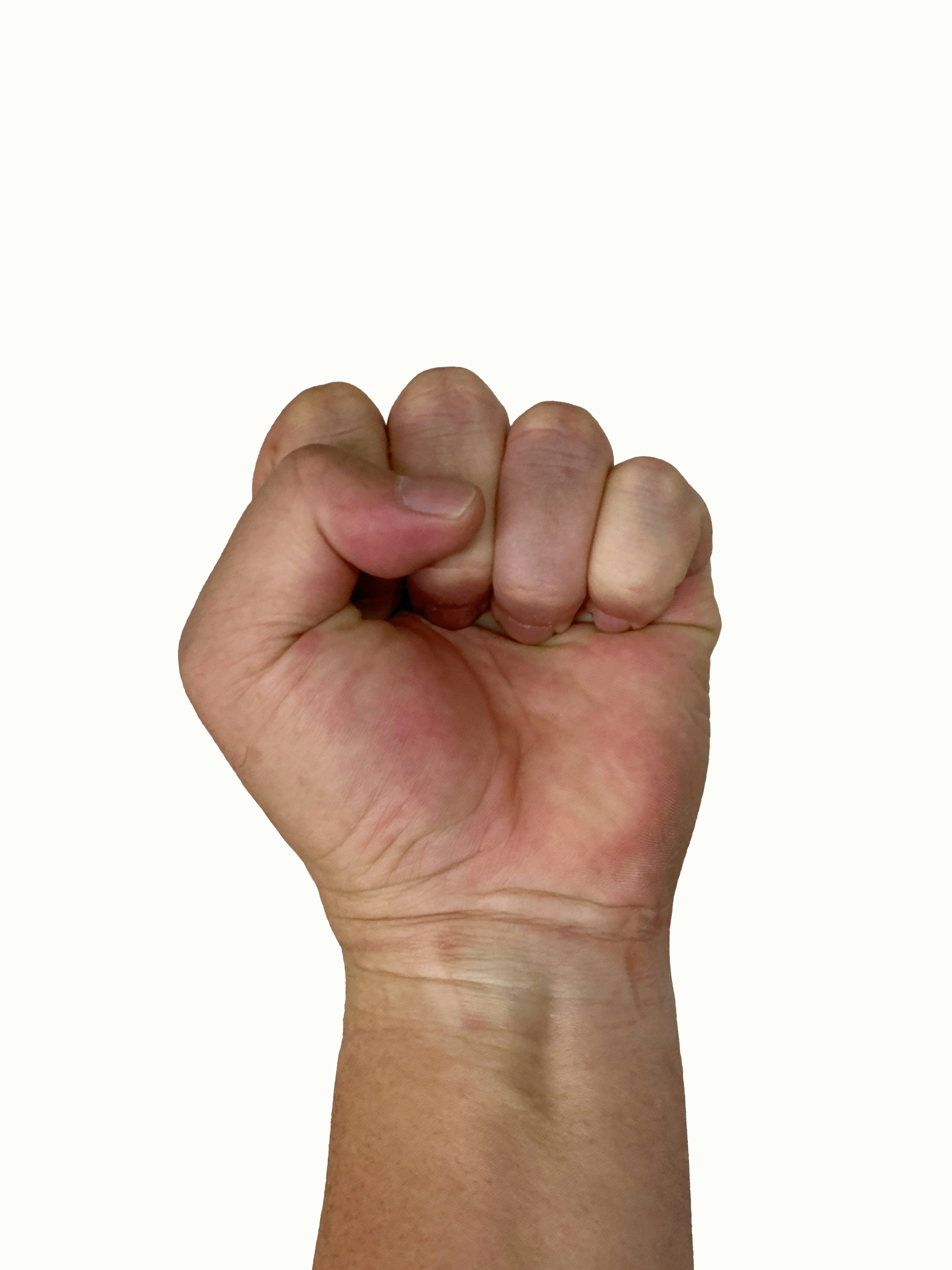 Photo of a hand making a fist